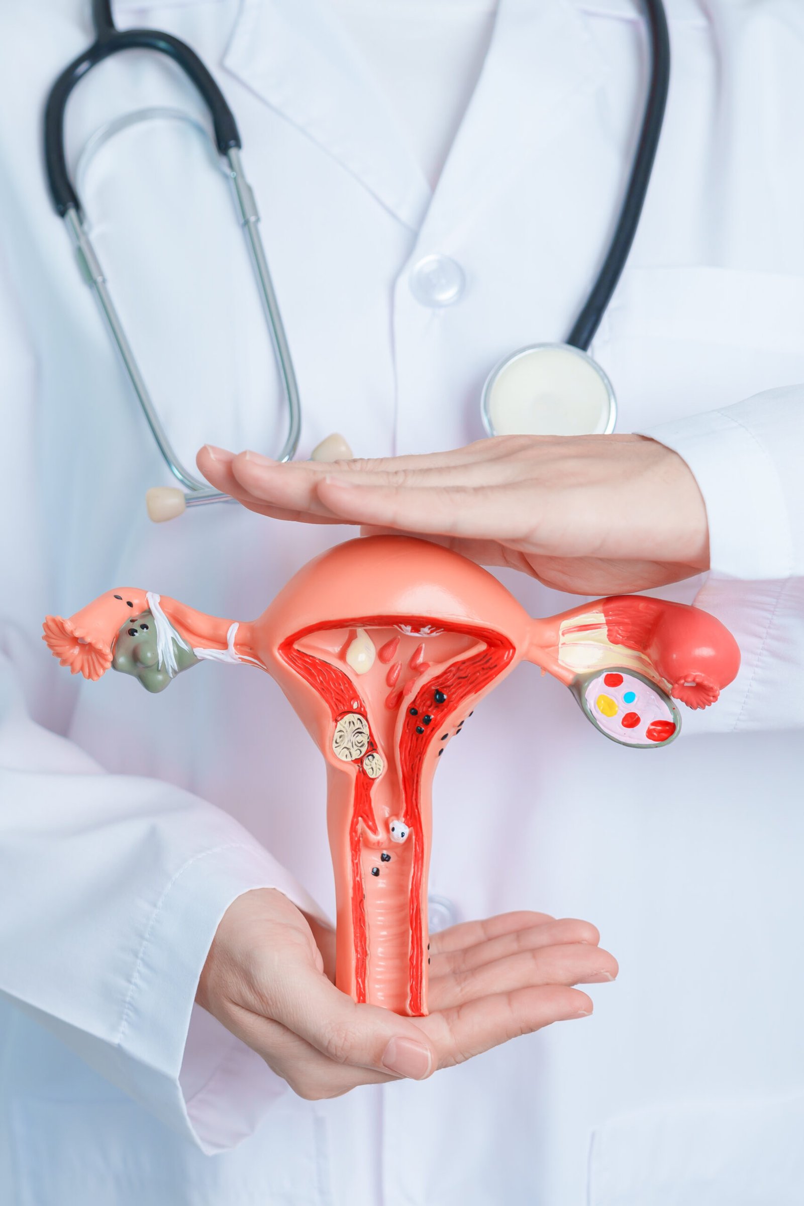 Doctor holding Uterus and Ovaries model. Ovarian and Cervical cancer, Cervix disorder, Endometriosis, Hysterectomy, Uterine fibroids, Reproductive system and Pregnancy concept
